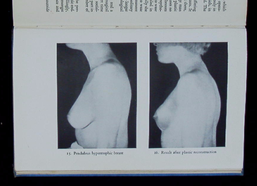 71306AB.jpg